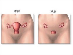女性分娩后如何能促进子宫恢复
