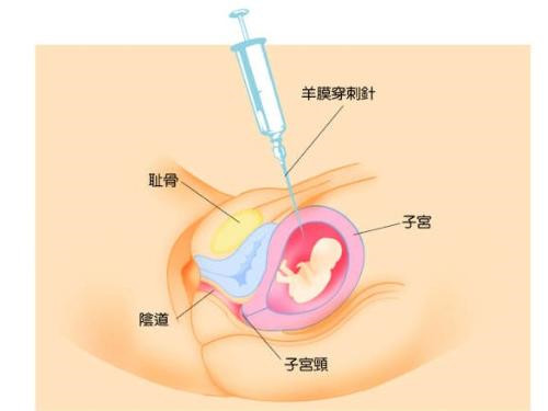 胎儿位置示意图