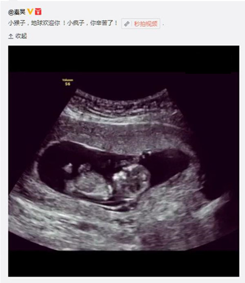 伊能静怀孕秦昊微博截图